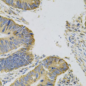 Immunohistochemistry - MYD88 Polyclonal Antibody (144-60032)