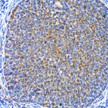 Immunohistochemistry - MAP1LC3A antibody (144-011438)