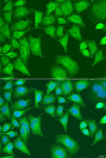 Immunofluorescence - SQSTM1 Polyclonal Antibody (144-07758)