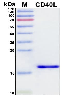SDS-PAGE Image