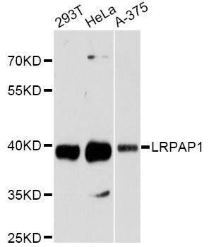 Western blot - LRPAP1 antibody (144-60152)