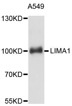 Western blot - LIMA1 antibody (144-011682)