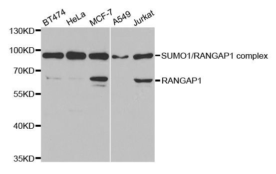 Western blot - RANGAP1 antibody (144-05381)