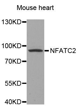 Western blot - NFATC2 antibody (144-03107)