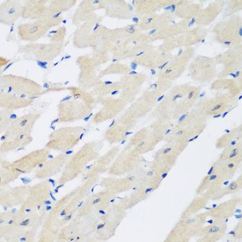 Immunohistochemistry - PLEK antibody (144-06305)