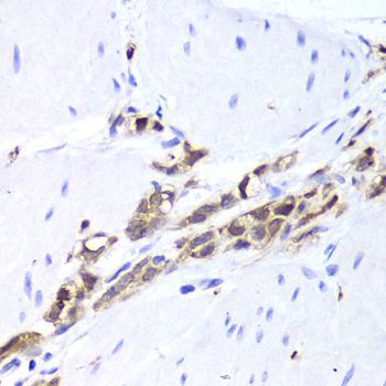 Immunohistochemistry - TPPP3 antibody (144-06775)