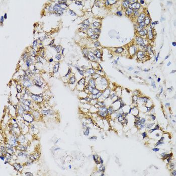 Immunohistochemistry - CHN1 antibody (144-07546)