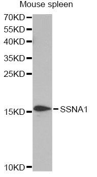 Western blot - SSNA1 antibody (144-013377)