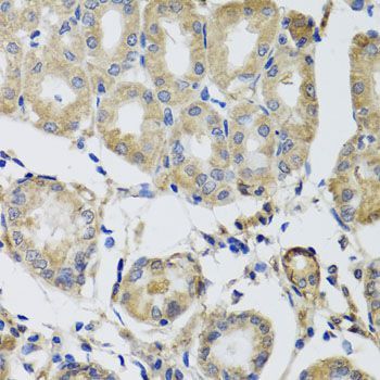 Immunohistochemistry - MRPS22 antibody (144-08319)