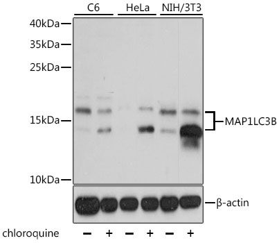 Western blot - MAP1LC3B Polyclonal Antibody (144-07198)