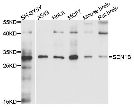 Western blot - SCN1B Polyclonal Antibody (144-10071)