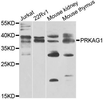 Western blot - PRKAG1 antibody (144-07300)