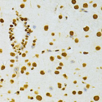 Immunohistochemistry - ALYREF antibody (144-06010)