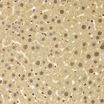 Immunohistochemistry - ANP32A Antibody (144-05768)