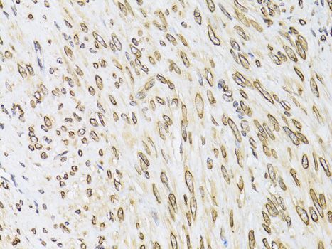 Immunohistochemistry - EMD Polyclonal Antibody (144-60520)