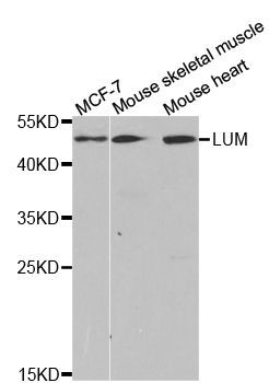Western blot - LUM antibody (144-05352)