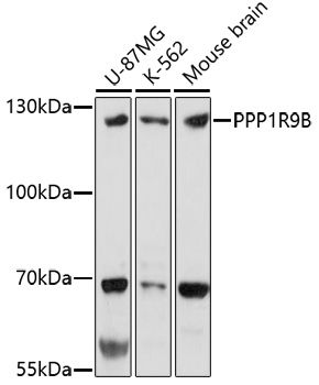 Western blot