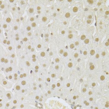 Immunohistochemistry - SFN Polyclonal Antibody (144-01026)