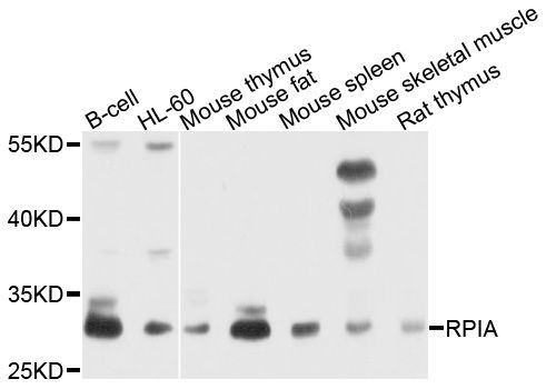 Western blot - RPIA antibody (144-08867)