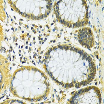 Immunohistochemistry - SLC25A1 Polyclonal Antibody (144-010247)