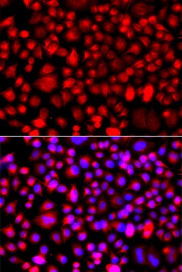 Immunofluorescence - ALG1 antibody (144-07818)