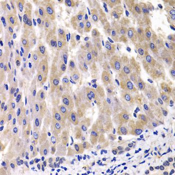 Western blot - RPL14 Polyclonal Antibody (144-06724)