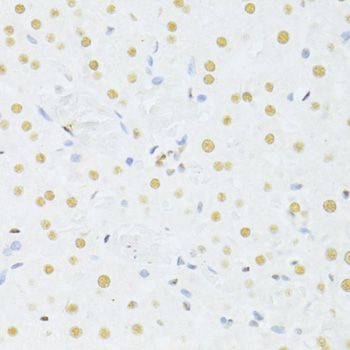 Immunohistochemistry - ALYREF antibody (144-06010)