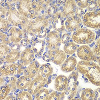Immunohistochemistry - PSMD9 antibody (144-05357)