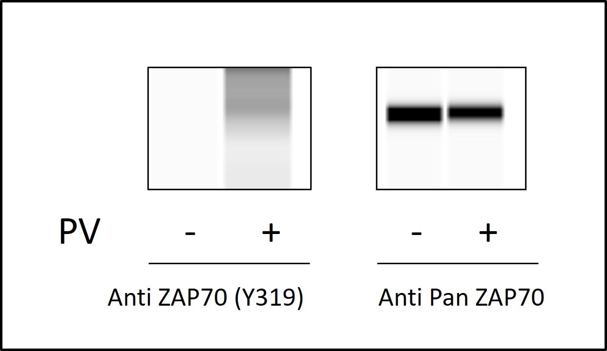ZAP70 (Tyr319) - Western Blot