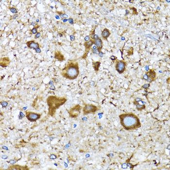 Immunohistochemistry - MAP1LC3A antibody (144-011438)