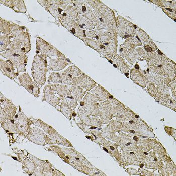 Immunohistochemistry - PHF1 antibody (144-08450)