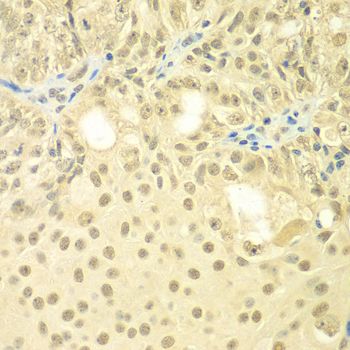 Immunohistochemistry - TBL1XR1 antibody (144-07834)