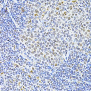 Immunohistochemistry - SNRNP70 antibody (144-06065)