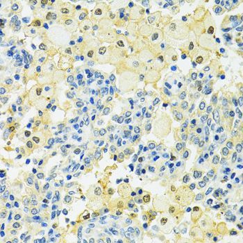 Immunohistochemistry - SLC25A1 Polyclonal Antibody (144-010247)