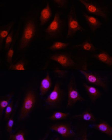 Immunofluorescence - YAP1 Polyclonal Antibody (144-01001)