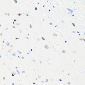 Immunohistochemistry - Acetyl-Histone H4-K5 pAb (144-60957)