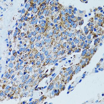 Immunohistochemistry - MRPL28 Polyclonal Antibody (144-05897)