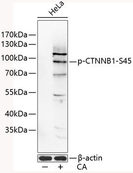 Western blot