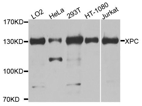 Western blot - XPC Polyclonal Antibody (144-08354)