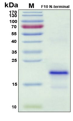 SDS-PAGE