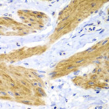 Immunohistochemistry - HRas Polyclonal Antibody (144-07901)