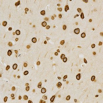 Immunohistochemistry - Lamin A/C Polyclonal Antibody (144-00249)