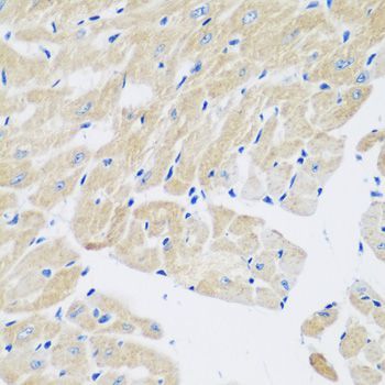 Immunohistochemistry - TGM5 antibody (144-07039)