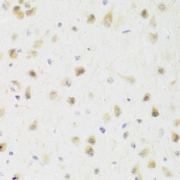 Immunohistochemistry - PAWR Antibody (144-03063)