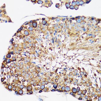 Immunohistochemistry - IRAK4 antibody (144-06208)
