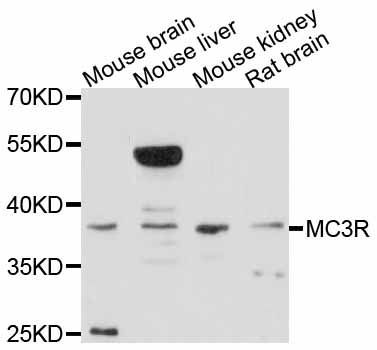 Western blot - MC3R antibody (144-011609)