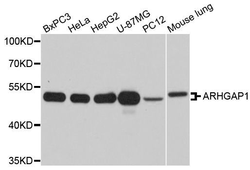 Western blot - ARHGAP1 Polyclonal Antibody (144-03739)
