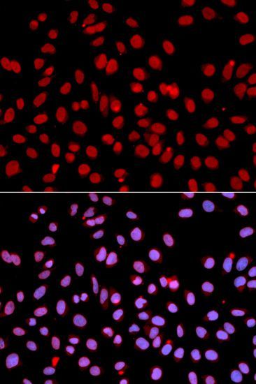 Immunofluorescence - POLR2J Polyclonal Antibody (144-01843)