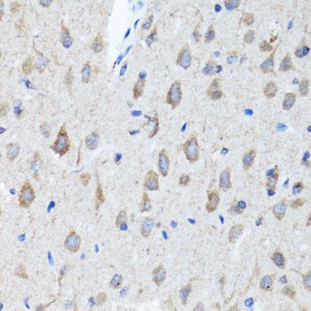 Immunohistochemistry - CHAT antibody (144-02495)