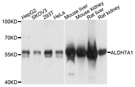 Western blot - ALDH7A1 Polyclonal Antibody (144-08629)